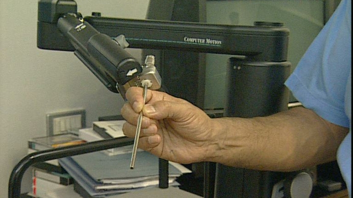 Robo surgery Robo surgery