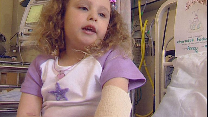 Brittle Bones Brittle Bones