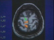 Brain Scans