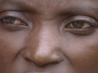 Sowing the Seeds of Hunger